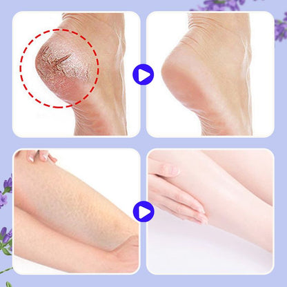 🔥Sålda över 100 000 ❤️Närande och reparerande fotkräm mot sprickor🎁50% rabatt på förmåner under begränsad tid