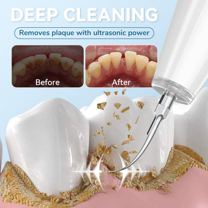 Smart ultraljudsvattenflosser för tänder